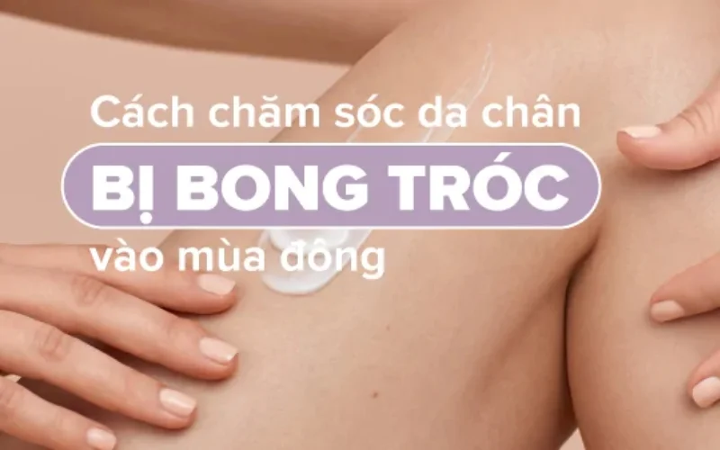 Cách chăm sóc da chân bị bong tróc vào mùa đông