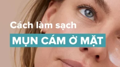 Chuyên gia chia sẻ cách làm sạch mụn cám ở mặt hiệu quả