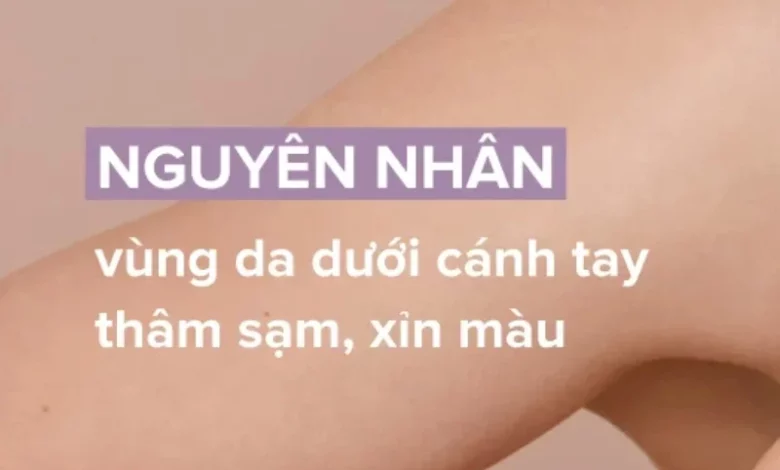 Nguyên nhân da vùng nách bị thâm sạm và cách khắc phục hiệu quả