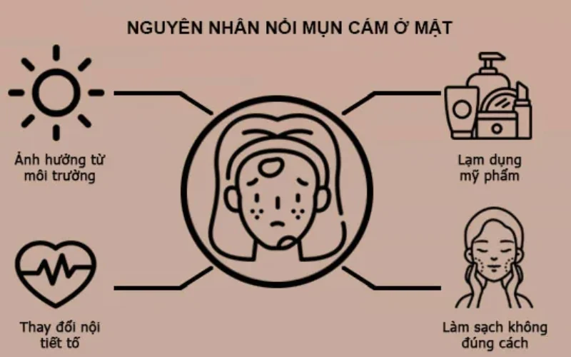 Nguyên nhân gây ra mụn cám