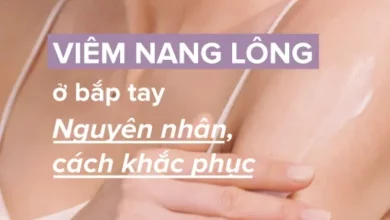 Nguyên nhân viêm nang lông ở bắp tay và cách cải thiện