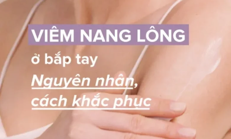 Nguyên nhân viêm nang lông ở bắp tay và cách cải thiện